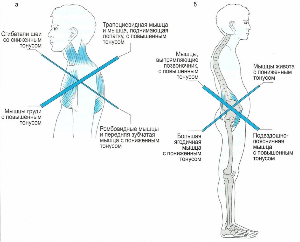 Баланс мышц