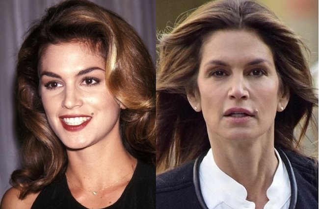 Мышечный тип старения